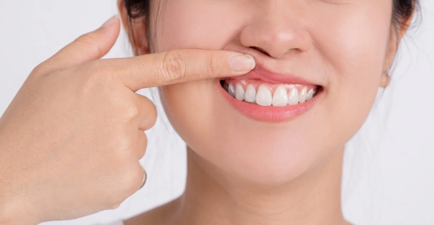 Peripheral Artery Disease and Periodontitis inblog